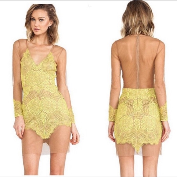 Yellow lace and mesh stunning dress - Picture 3 of 6